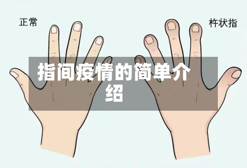 指间疫情的简单介绍