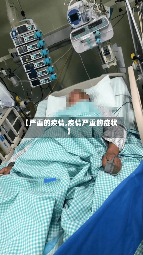 【严重的疫情,疫情严重的症状】-第3张图片